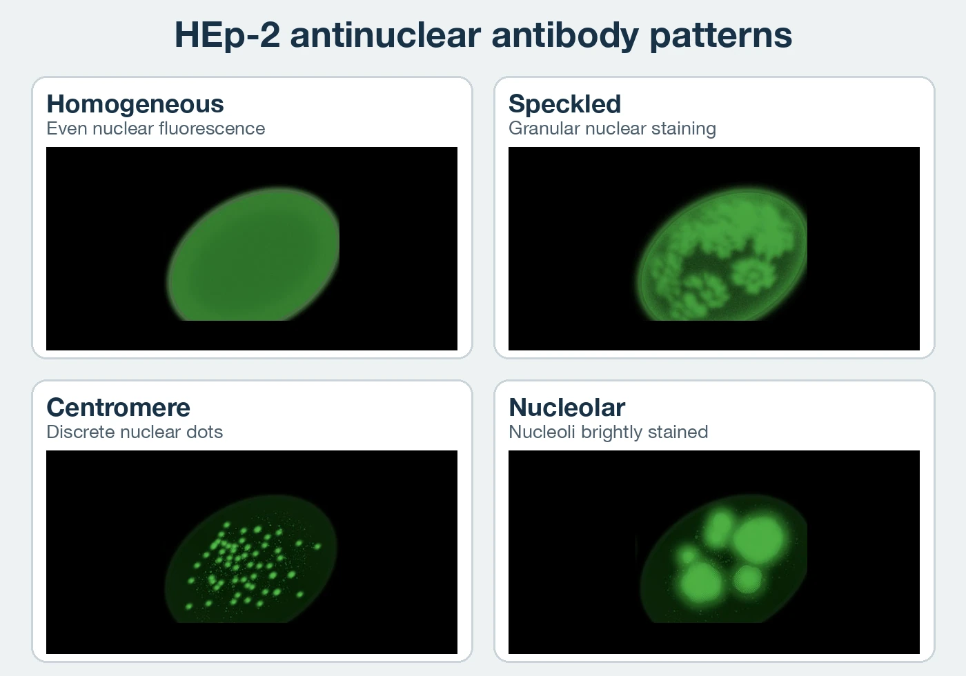 Four HEp-2 immunofluorescence fields compare ANA patterns. Homogeneous shows one evenly fluorescent nucleus. Speckled shows granular nuclear staining. Centromere shows many discrete bright nuclear dots. Nucleolar shows several large brightly stained nucleoli within a dimmer nucleus.