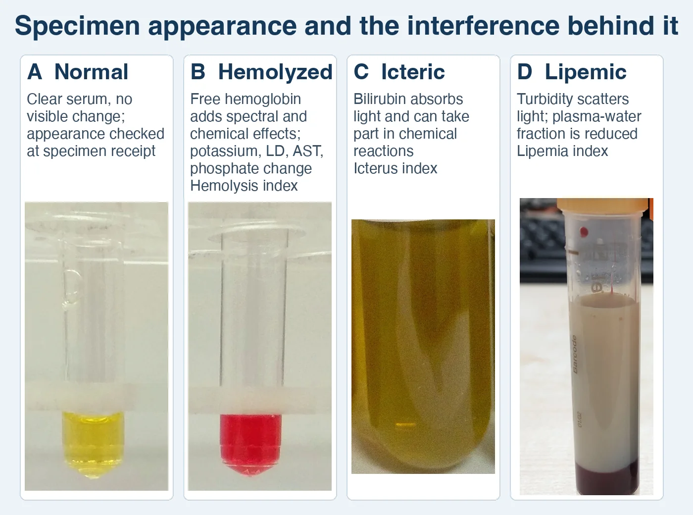 Four photographed specimens in a row. A normal serum cup holds clear yellow serum. A hemolyzed serum cup from the same rack holds bright red serum. An icteric tube holds dark olive-yellow serum. A lipemic tube holds milky, opaque plasma above a dark packed-cell layer. Cards B to D name the interference mechanism and the analyzer index that flags it.