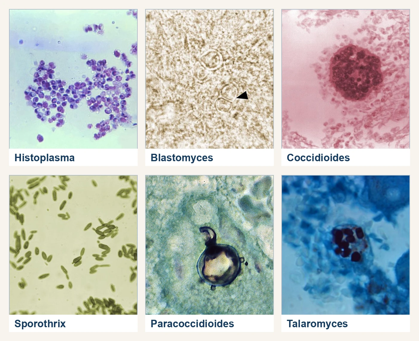 Six photomicrographs show Histoplasma yeast, a broad-based budding Blastomyces cell, a Coccidioides spherule with endospores, elongated Sporothrix yeast, a multiple-budding Paracoccidioides cell, and intracellular Talaromyces yeast.