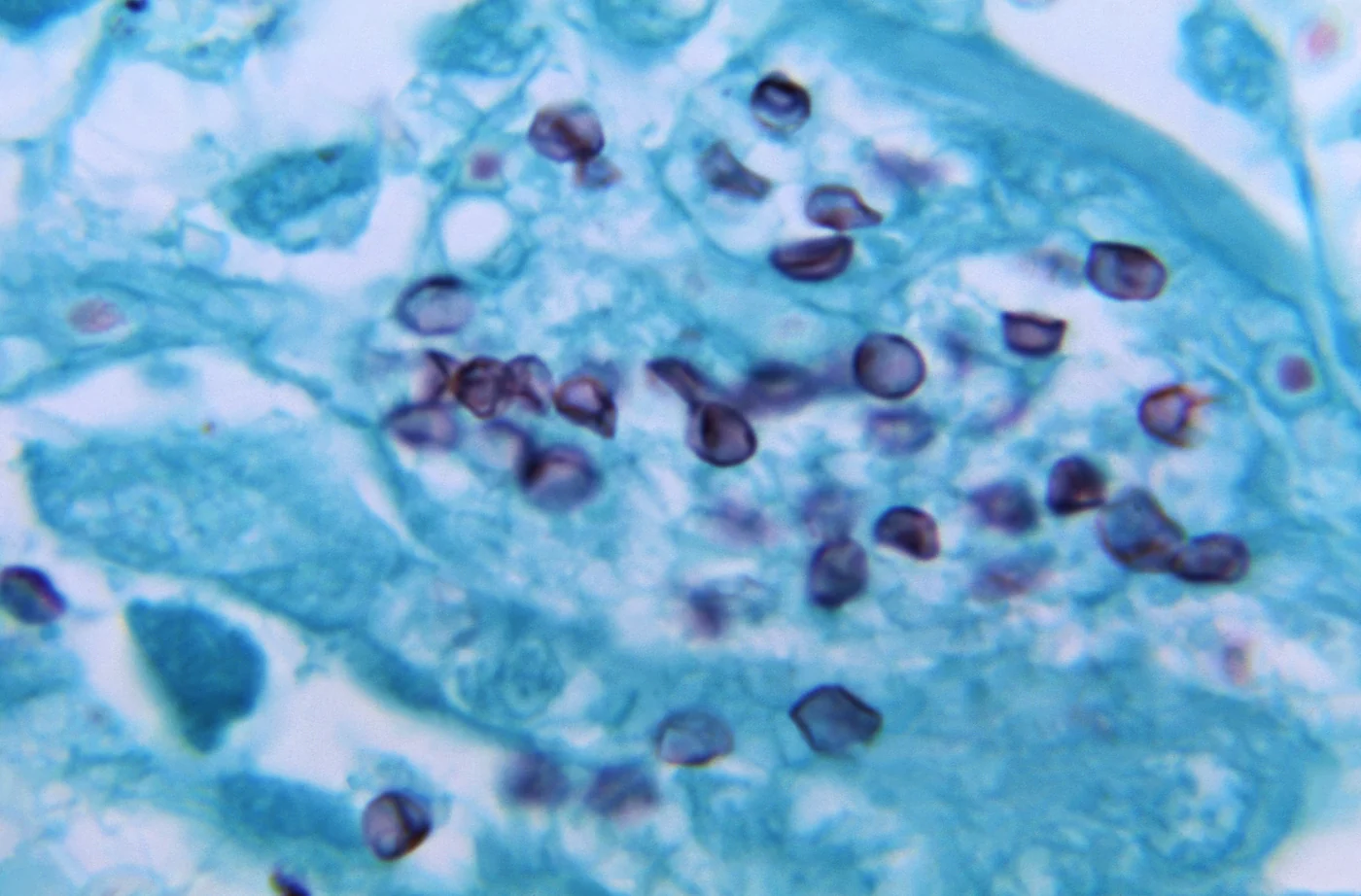 Lung tissue with a pale green background holding about two dozen round and cup-shaped organisms, each with a dark brown-black outlined wall and a paler center, scattered singly and in small clusters.