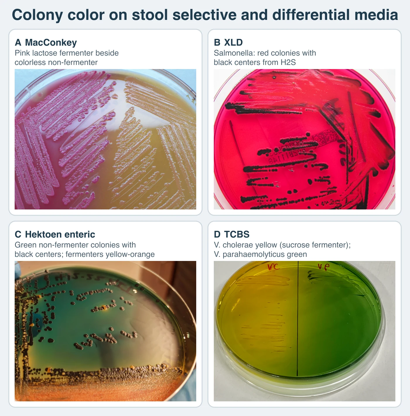 Four culture plates. MacConkey: bright pink streaked colonies on the left half of the plate and pale colorless colonies on the right, both on tan agar. XLD: red agar with streaks of colonies that have jet-black centers. Hektoen enteric: blue-green agar with rows of dark green-black colonies and an orange-yellow zone of fermenting growth along the lower edge. TCBS: a plate divided in half, the left side turned yellow by Vibrio cholerae growth and the right side green under Vibrio parahaemolyticus.