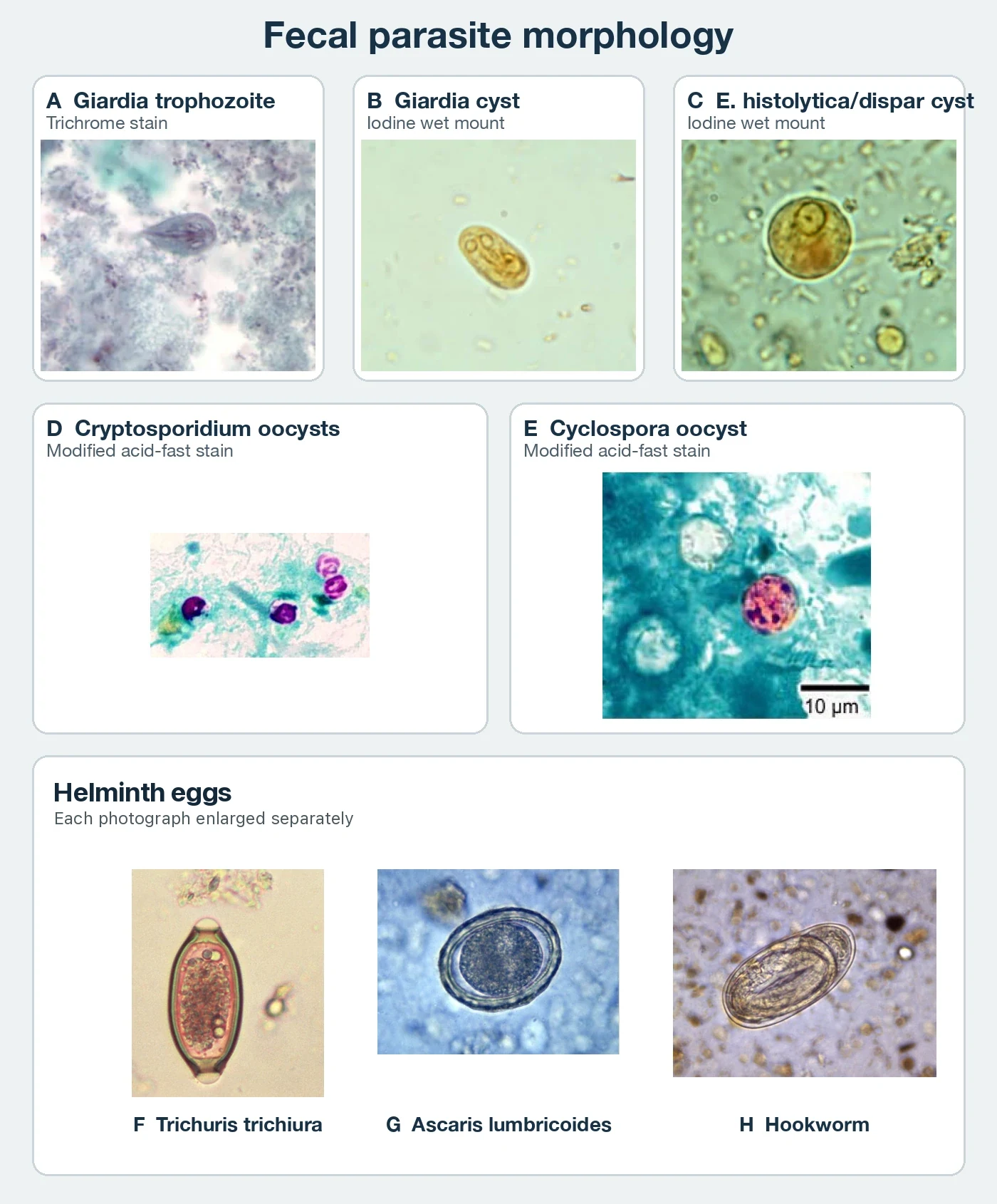 Eight labeled parasite photographs. The protozoan panels show a trichrome-stained Giardia trophozoite, an iodine wet-mount Giardia cyst, an iodine wet-mount Entamoeba histolytica or dispar cyst, modified acid-fast Cryptosporidium oocysts, and a modified acid-fast Cyclospora oocyst. The lower row shows Trichuris, fertilized Ascaris, and hookworm eggs, each photograph enlarged separately.