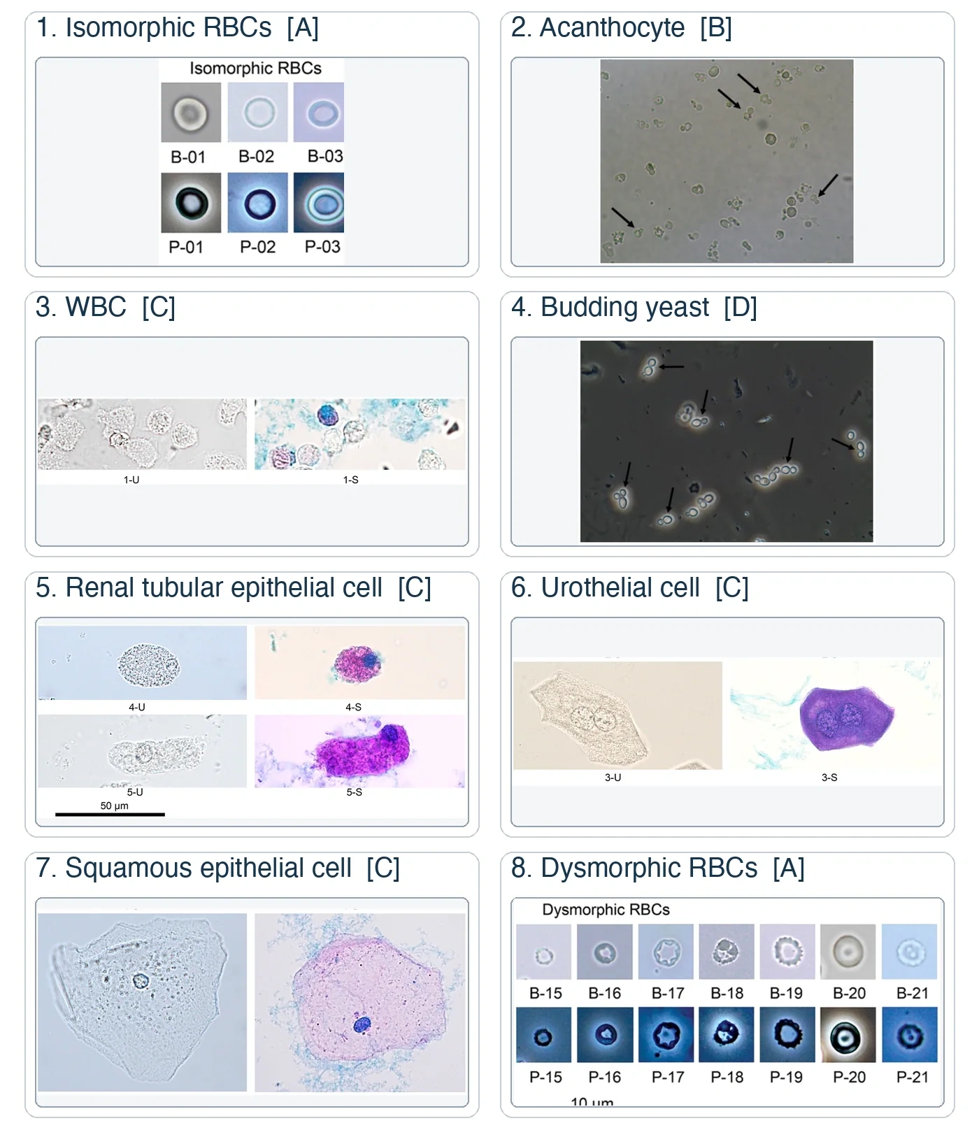 Eight numbered urine sediment photomicrograph panels: isomorphic RBCs, acanthocytes, WBCs, budding yeast, renal tubular epithelial cells, urothelial cells, squamous epithelial cells, and dysmorphic RBCs.