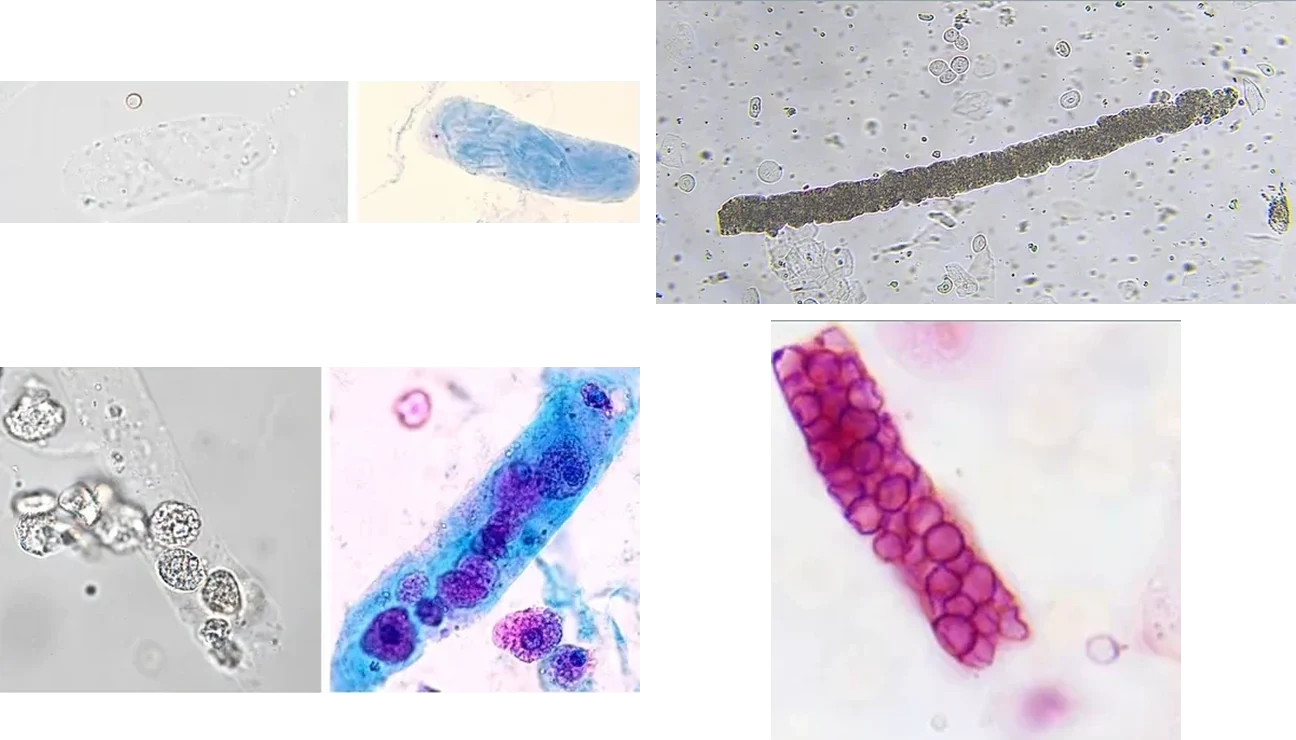 Four unlabeled urine sediment photomicrographs in two rows of two.