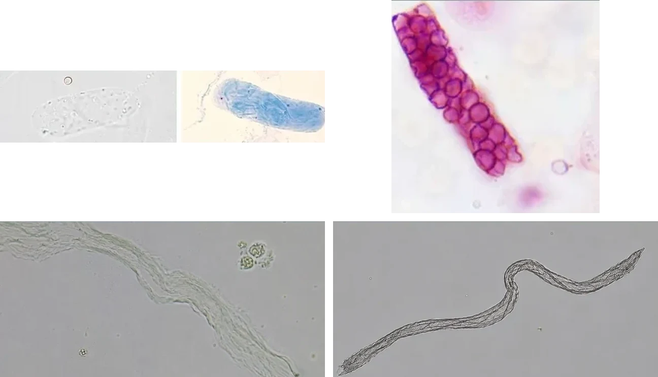 Four unlabeled urine sediment photomicrographs in two rows of two.