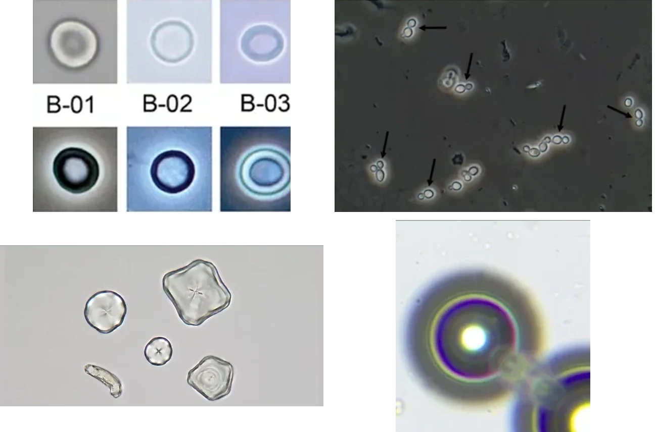 Four unlabeled urine sediment photomicrographs in two rows of two.