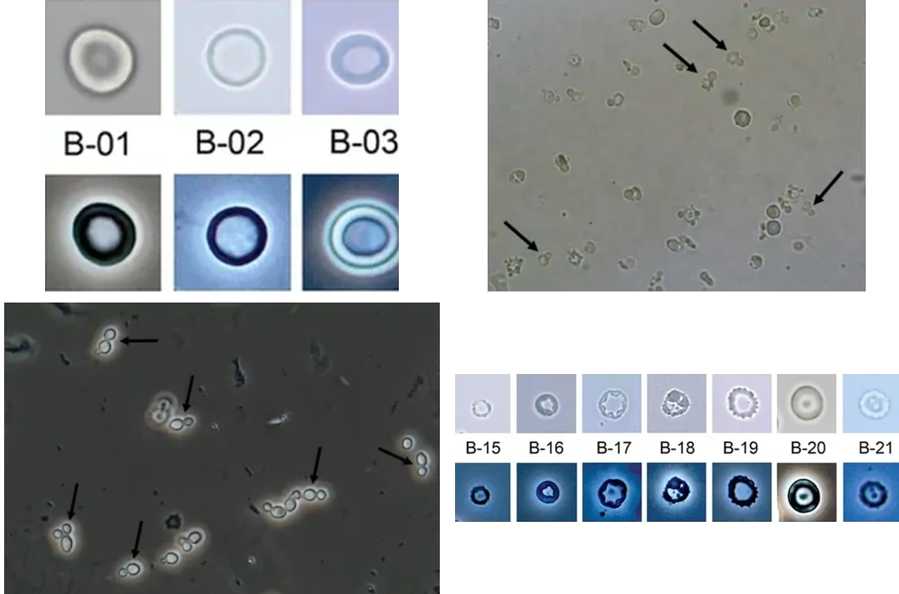 Four unlabeled urine sediment photomicrographs in two rows of two.
