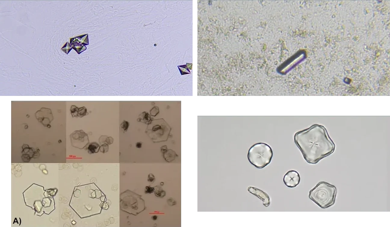 Four unlabeled urine sediment photomicrographs in two rows of two.